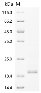 SDS-PAGE
