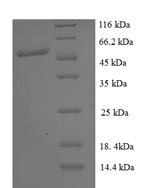 SDS-PAGE