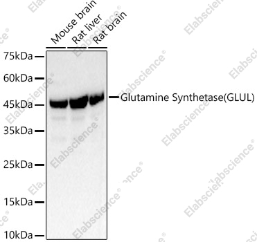 Вестерн-блоттинг, Glutamine Synthetase, различные лизаты