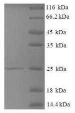 SDS-PAGE