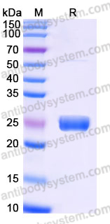EHJ37901, SDS-PAGE