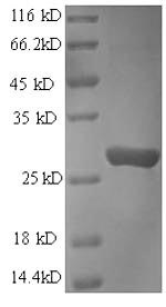 SDS-PAGE