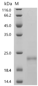 SDS-PAGE