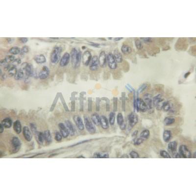 Валидация Affinity AF6182 - 3402