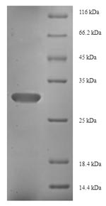 SDS-PAGE