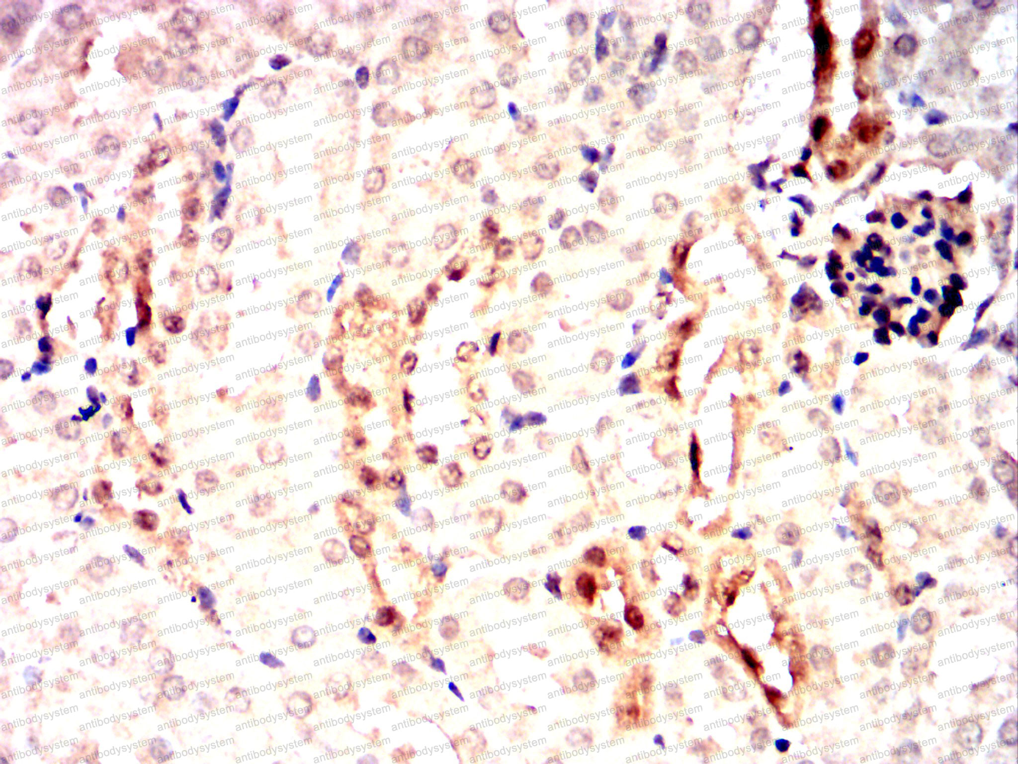 Валидация AntibodySystem RHE50004 (2210)