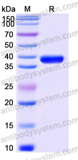 EHJ73401, SDS-PAGE