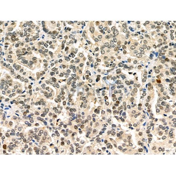 Валидация Affinity DF6502 - 17906