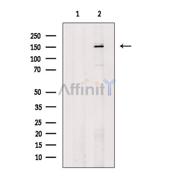 Валидация Affinity AF6895 - 4101
