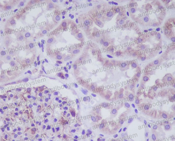 Валидация AntibodySystem RHJ96401