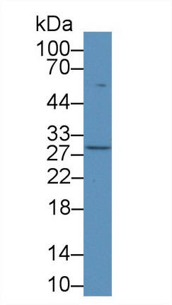 12961