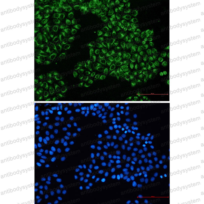 Валидация IF - AntibodySystem RHD52902