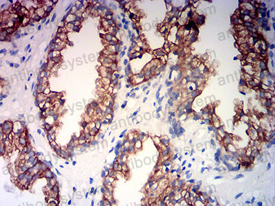Валидация AntibodySystem RHA06803
