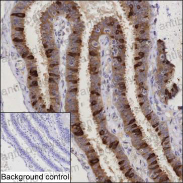 Валидация AntibodySystem RHK87401