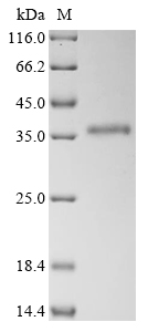 SDS-PAGE