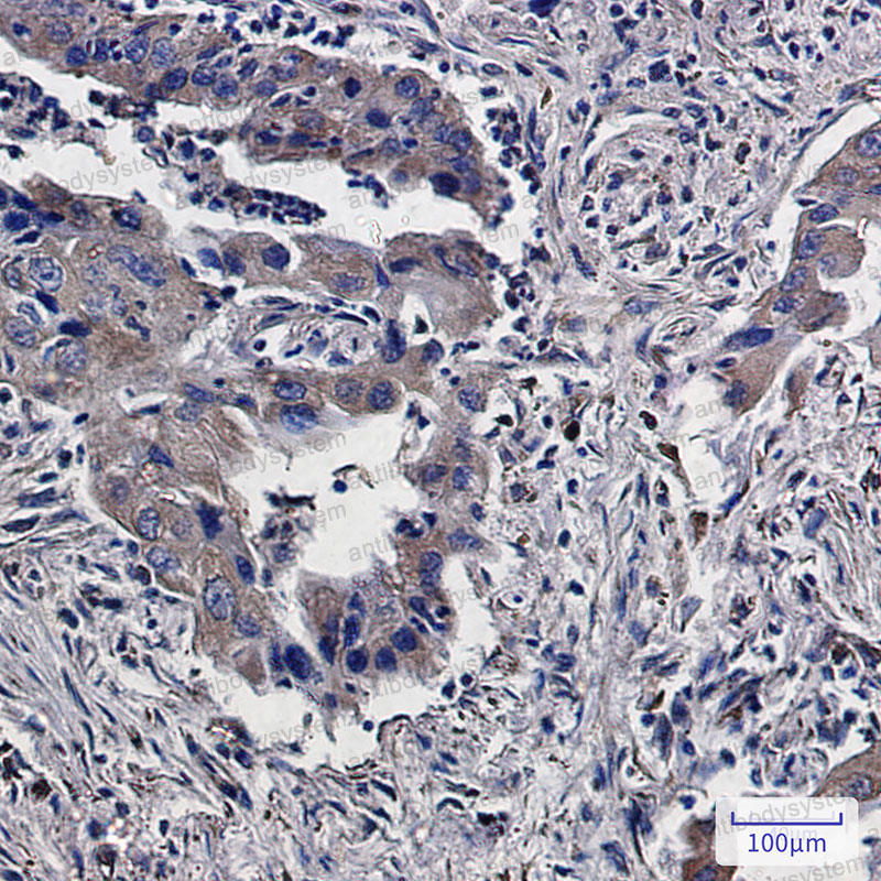 Валидация AntibodySystem RHE89704