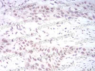 Валидация AntibodySystem RHJ72202