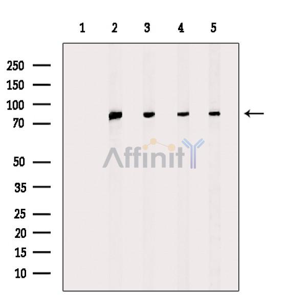 Валидация Affinity AF6696 - 3952