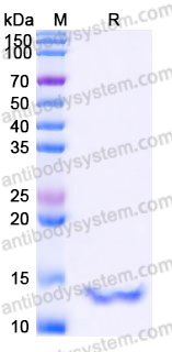 YHJ84802, SDS-PAGE