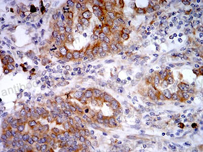 Валидация AntibodySystem RHN95701