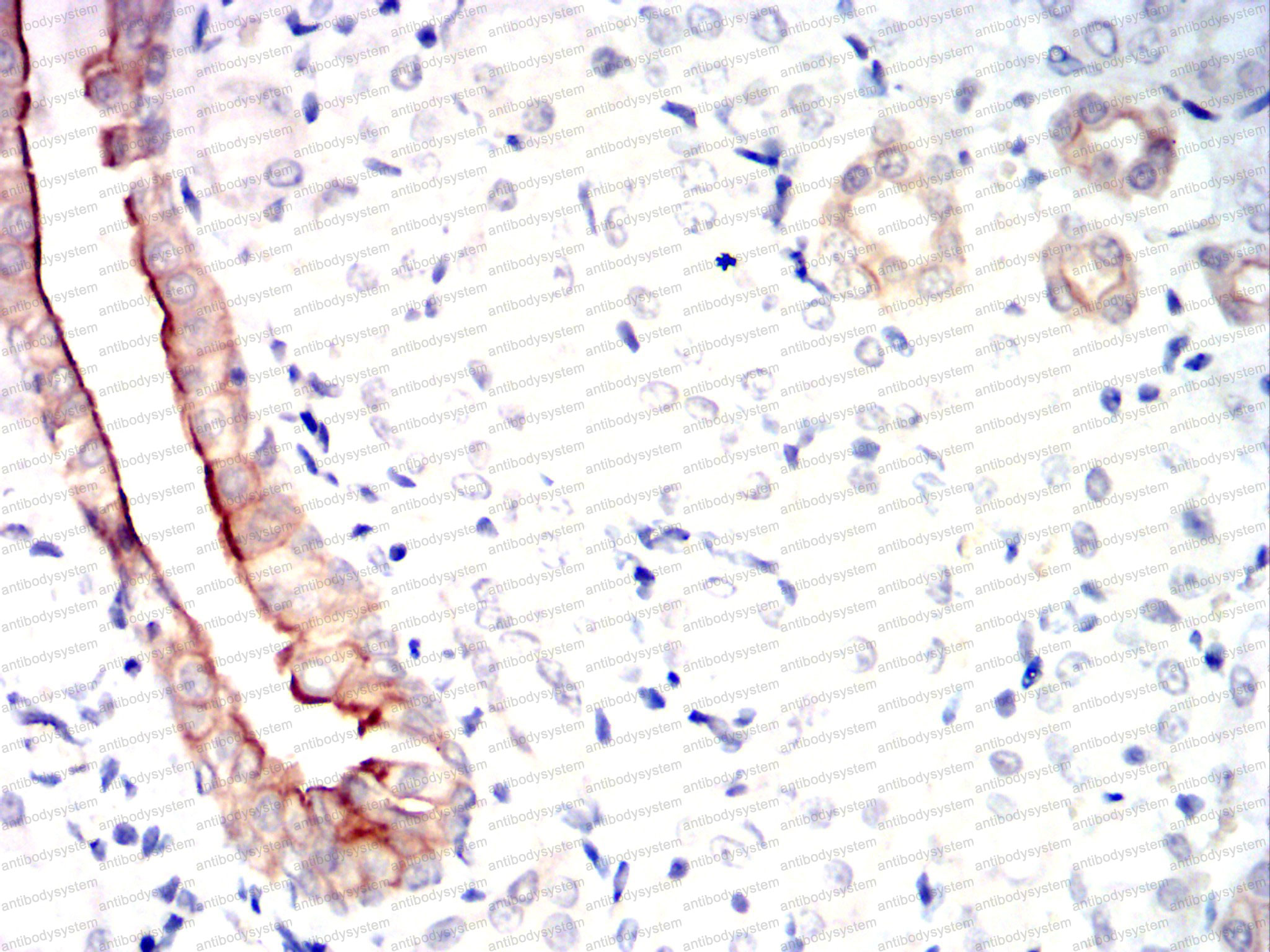 Валидация AntibodySystem RHD34504 (1512)