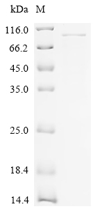 SDS-PAGE
