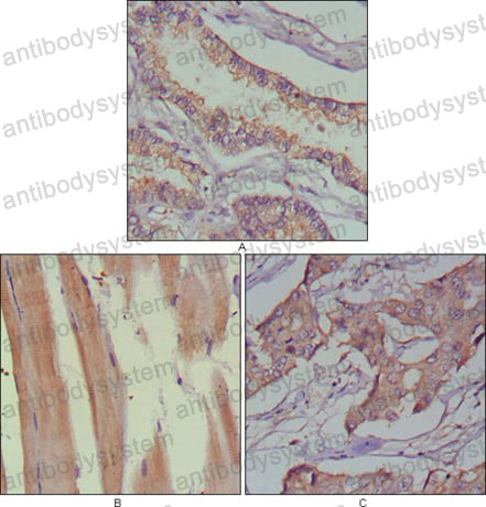 Валидация AntibodySystem RHA43102
