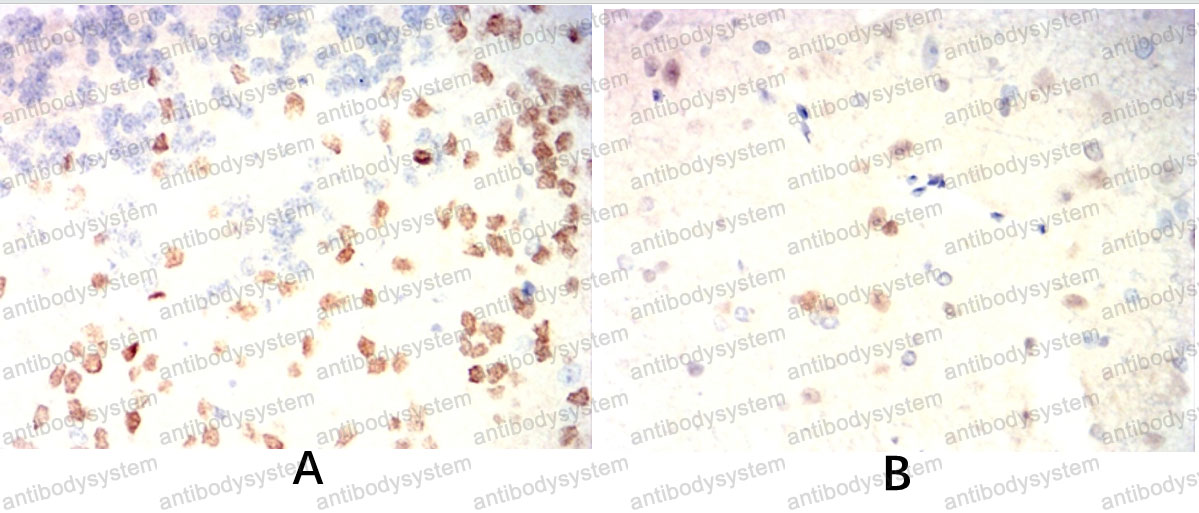 Валидация AntibodySystem RHE57501