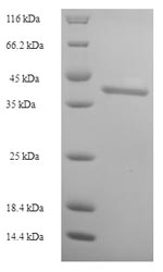 SDS-PAGE