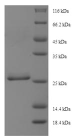 SDS-PAGE