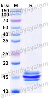 EHC01701, SDS-PAGE