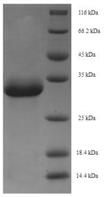 SDS-PAGE