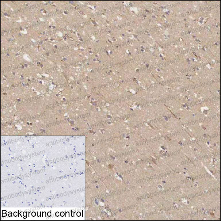 Валидация AntibodySystem RHA86701