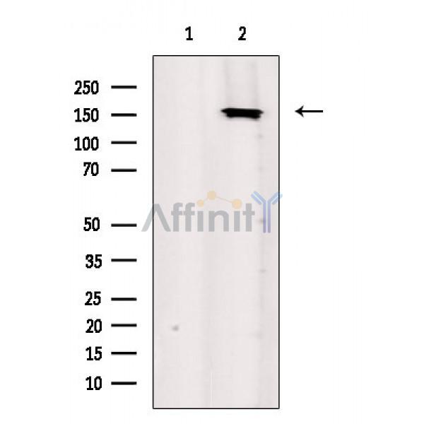 Валидация Affinity DF3876 - 15032