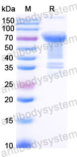 AHC43302, SDS-PAGE