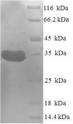 SDS-PAGE