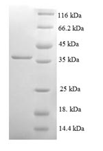 SDS-PAGE
