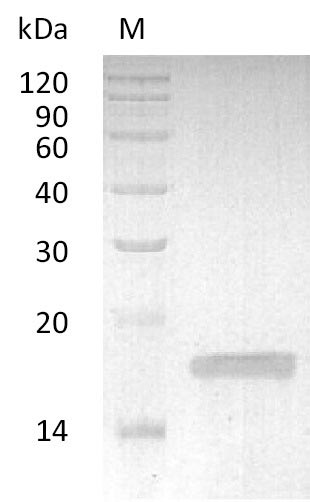 SDS-PAGE