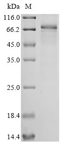 SDS-PAGE