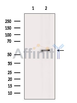 Валидация Affinity DF15595 - 12014