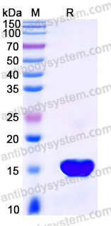 YHJ53202, SDS-PAGE
