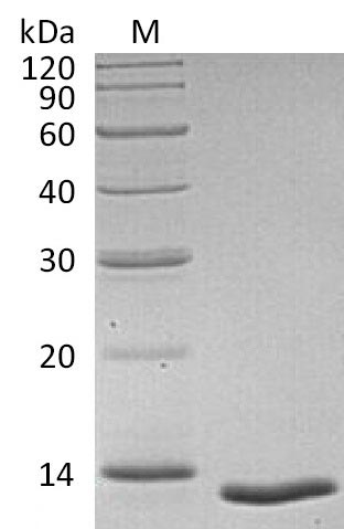 SDS-PAGE