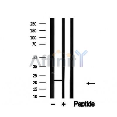 Валидация Affinity AF4660 - 2275