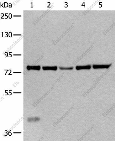 Вестерн-блоттинг, ATF6B, ткань печени мыши, клетки HeLa, ткань яичка человека, клетки Jurkat и HEPG2