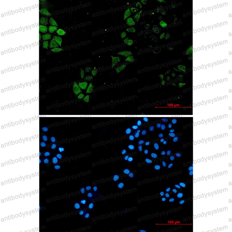 Валидация IF - AntibodySystem RHD71001