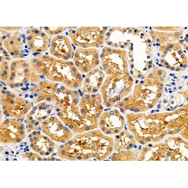 Валидация Affinity DF4908 - 16710