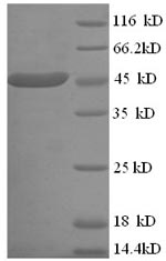 SDS-PAGE