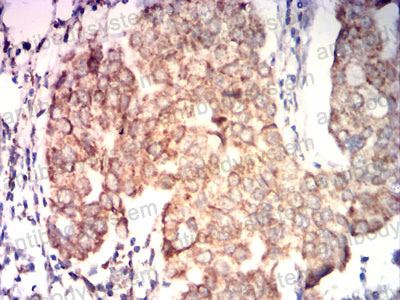 Валидация AntibodySystem RHD01401 (1273)