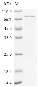 SDS-PAGE