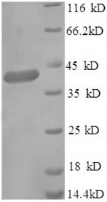 SDS-PAGE